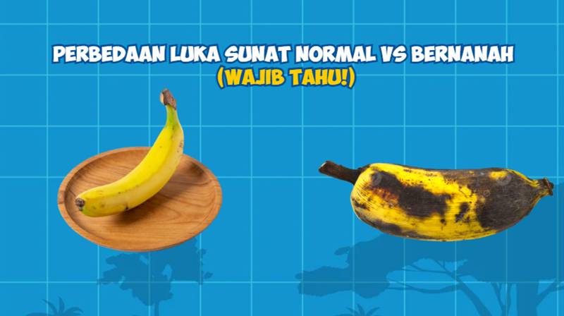 Perbedaan Luka Sunat Normal vs Bernanah Wajib Tahu