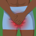 Balanitis: Pengertian, Gejala dan Penyebabnya