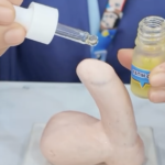 Mengenal Tahapan Pemulihan Luka Sunat demi Proses Penyembuhan yang Optimal