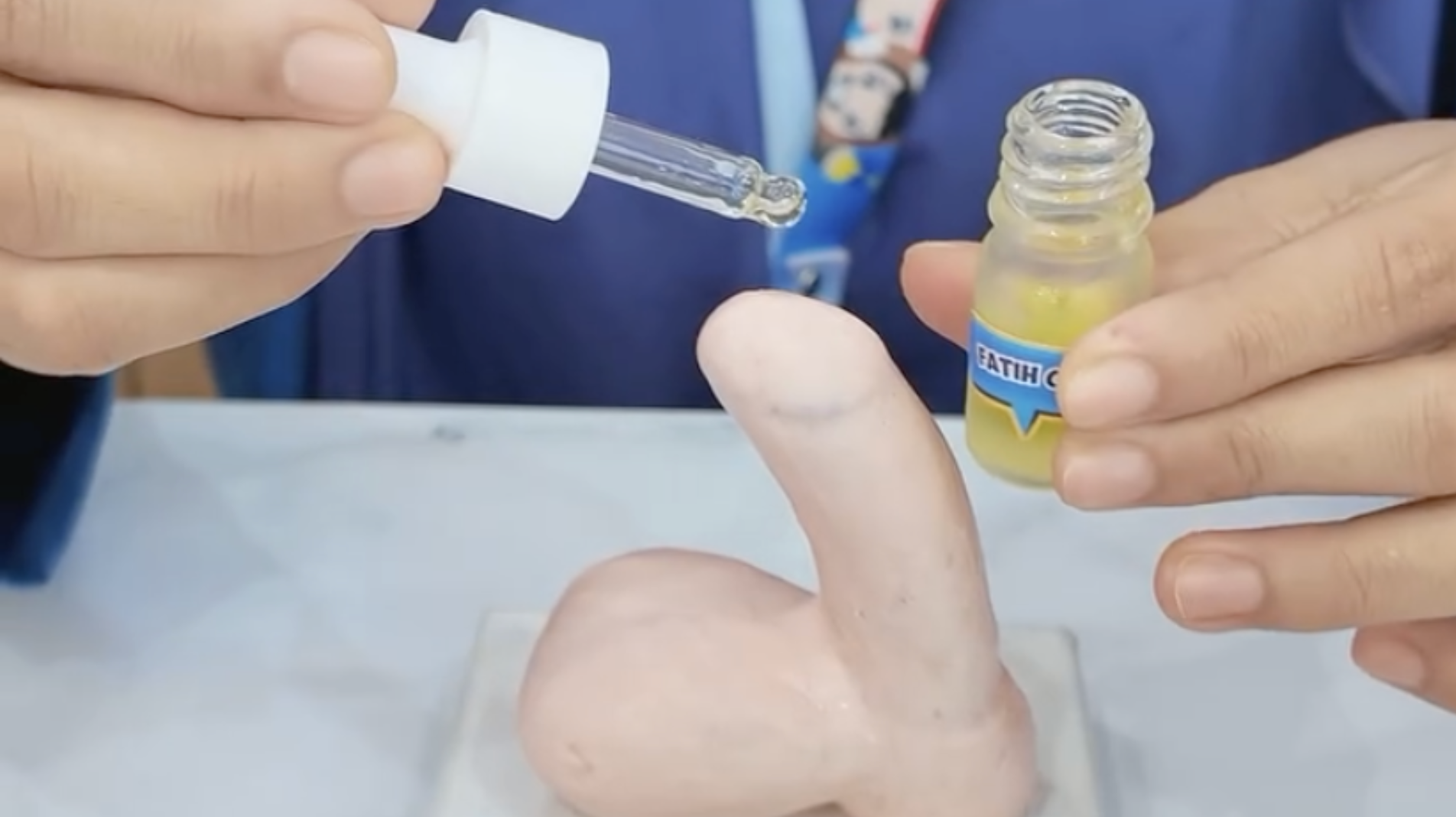 Mengenal Tahapan Pemulihan Luka Sunat demi Proses Penyembuhan yang Optimal