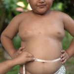 Ukuran Penis Anak Gemuk Cenderung Kecil, Apa Penyebabnya?