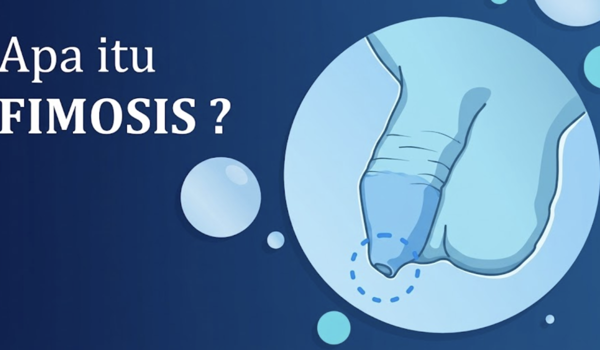 Apa Itu Fimosis? Gejala, Penyebab dan Pengobatannya