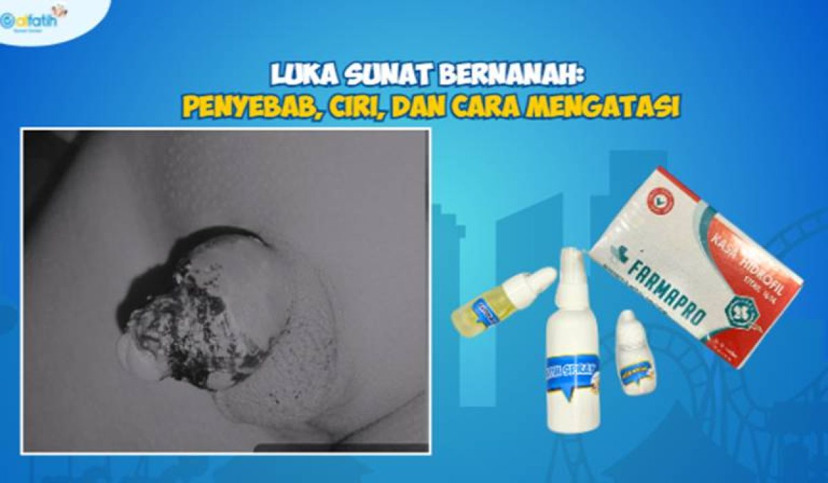 Luka Sunat Bernanah Penyebab, Ciri, dan Cara Mengatasi