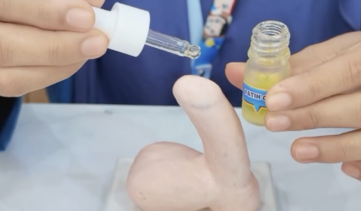 Mengenal Tahapan Pemulihan Luka Sunat demi Proses Penyembuhan yang Optimal