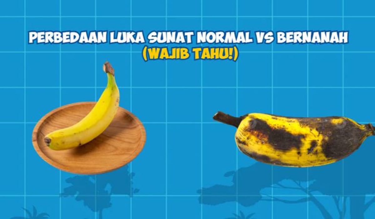 Perbedaan Luka Sunat Normal vs Bernanah (Wajib Tahu!)