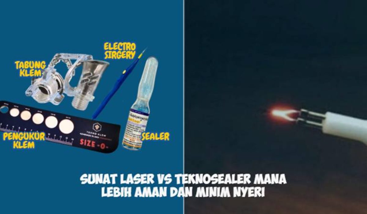 Sunat Laser vs Teknosealer Mana Lebih Aman dan Minim Nyeri